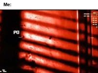 Gym Buddy Wanna Skip Legs And Hit Chest Again Me